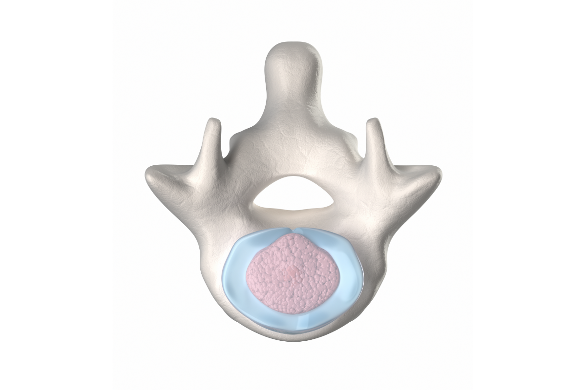 What are Pelvic Floor Exercises for Preventing Prolapses